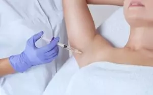 axillary hyperhidrosis, underarm sweating treatment