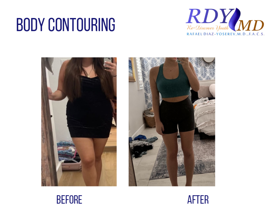 BEFORE AND AFTER SEMAGLUTIDE