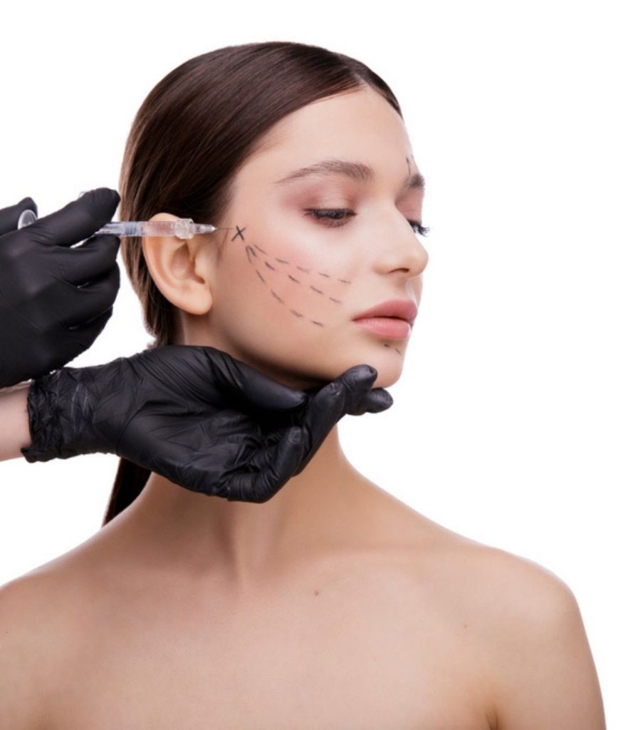 BIOSTIMULATOR DILUTED RADIESSE