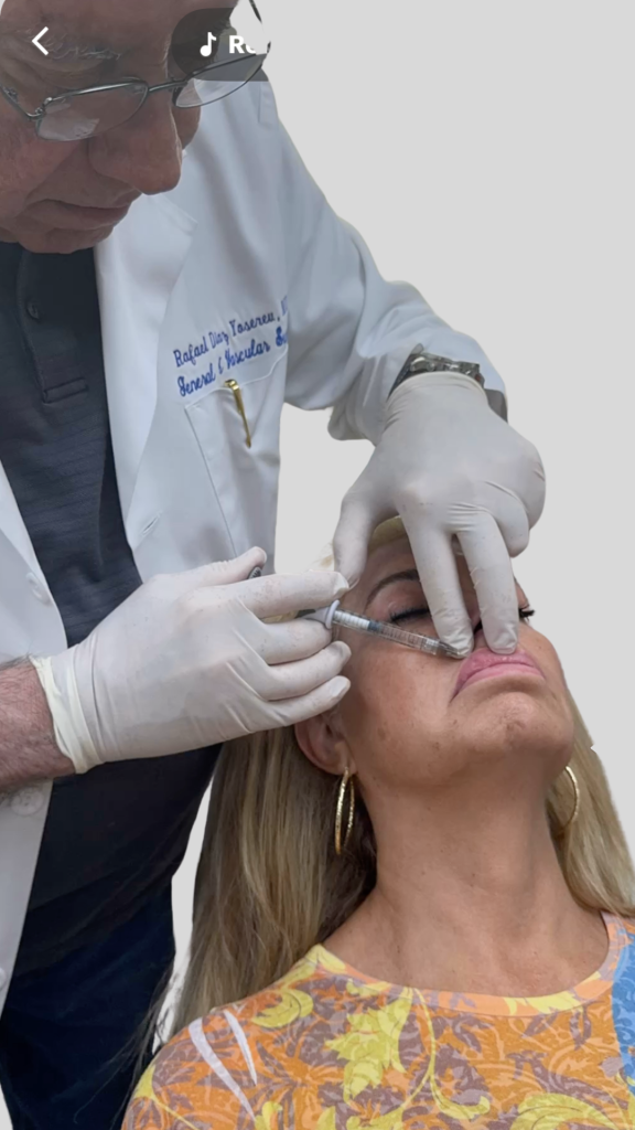 DR RAFAEL DIAZ-YOSEREV RDYMD MEDICAL SPA LIP FILLER
